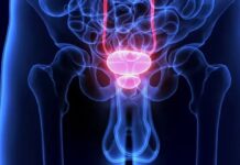 Puede costar la vida a los hombres que retrasan sus consultas urológicas por vergüenza